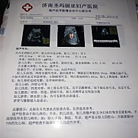 双胞胎四维有会看男孩女孩的吗？大家帮忙看一下。