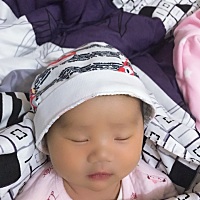 宝贝出生半个多月了脸上还有黄疸想请教一下各位宝妈如何做才能消退？🙏🙏🙏