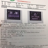 大家帮看看男还是女。该准备衣服了。