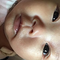 宝妈们，你们知道宝宝下巴这一颗颗的是什么东西，一直退不下去，也不像湿疹啊，要怎么办