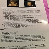 昨晚一直但心紧张，一个晚上都没有怎么睡着，不过现在没事了，看到宝宝发育很好，心里面的踏实啦……看...