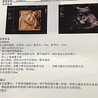 麻烦各位猜猜是男宝还是女宝呀