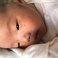宝宝第18天，脸上长这个第二天，有经验的告知一下，这是湿疹吗？需要怎么处理