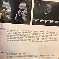 心操顺利过了🙏