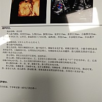 大家觉得是男孩还是女孩，我本人希望是个女儿，二胎凑个“好”字。