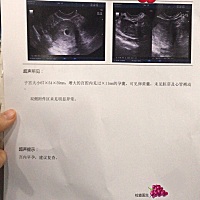 孕6周➕3昨天去检查 没有胎心胎芽 心里怕的狠啊。。。有没有一样的做妈妈呀