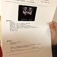 16➕3，今天去做B超胎位在臀部，胎盘低置， 怎么办，