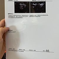 有人帮我看看我的检查报道吗？