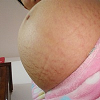 什么时候才卸货啊   妊娠纹好多  🙈🙈🙈🙈🙈🙈