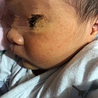 大家能帮我看看宝宝脸上是湿疹吗？好着急好心痛。怎么才能快速消下去啊？平时没开空调暖气，也没有穿很...