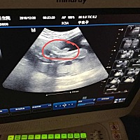 哈哈，这是小弟弟吗，医生说是，但是我不会看。