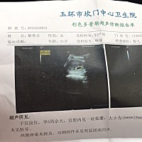 现在每天胃都很难受，好睡觉，男朋友还说我什么都不干，真是没谁了，