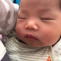 宝宝脸上好多这种小红点还有胸上，大家看下怎么回事