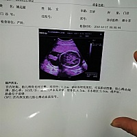 有谁会看男宝女宝吗，生什么都好，有点好奇！