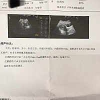 孕妈们帮我看看，这是什么意思啊？医生就是让复查我也看不懂这个😿