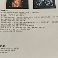 有没有会看男女的。 好奇