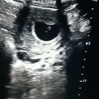 各位大神分析的出来男宝还是女宝吗？😄