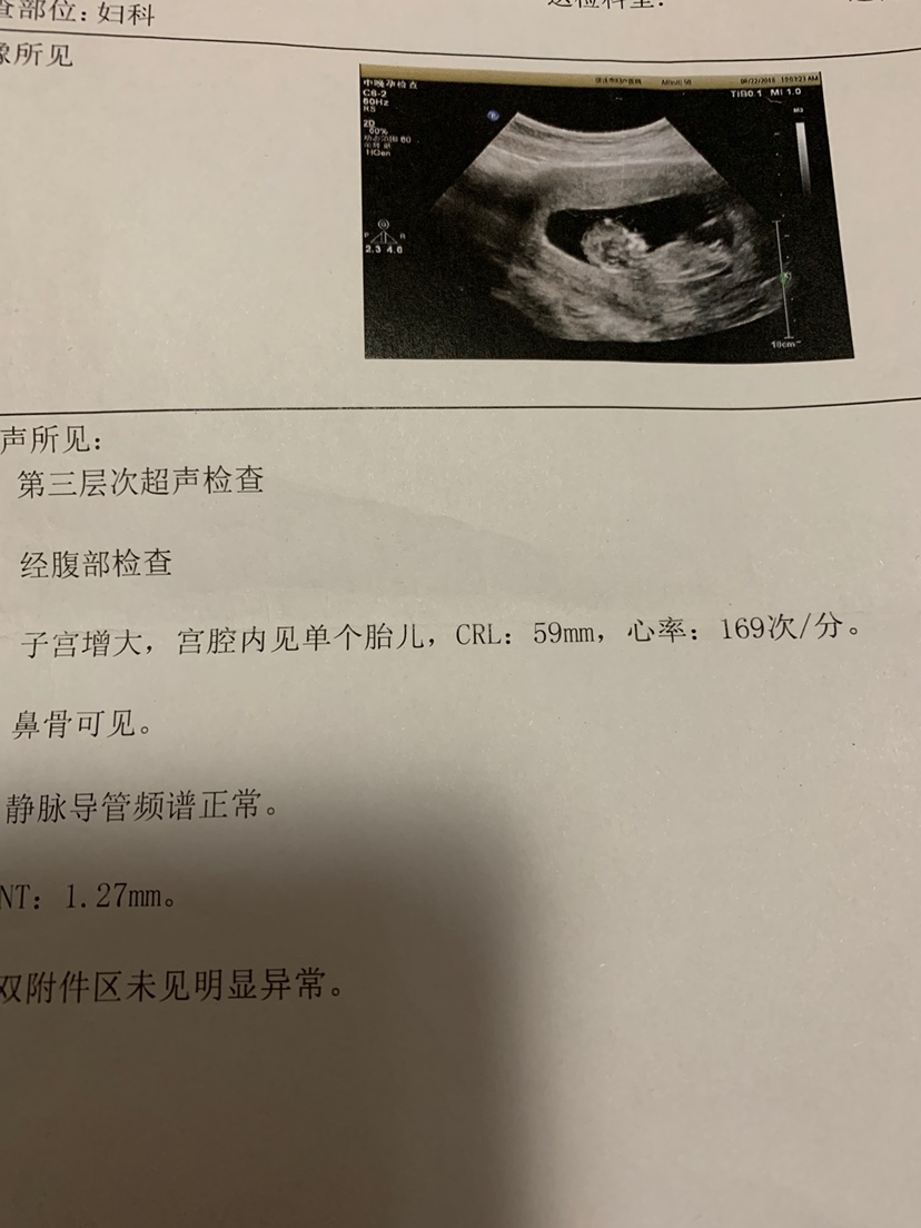 一切正常，就想问问谁能看懂是男孩还是女孩