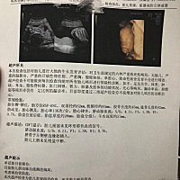 看的出来男孩儿还是女孩儿吗