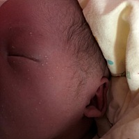 宝宝脸上这个痘痘多久消下去啊，有没有宝妈知道的啊