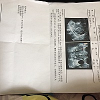 怀孕40天不懂啥意思 有懂的帮忙看一下