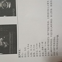 今天在检查B超时医生问了宝爸多高，还有我这个宝妈多高，有知道为什么这么问吗？我问医生为什么这么问医...