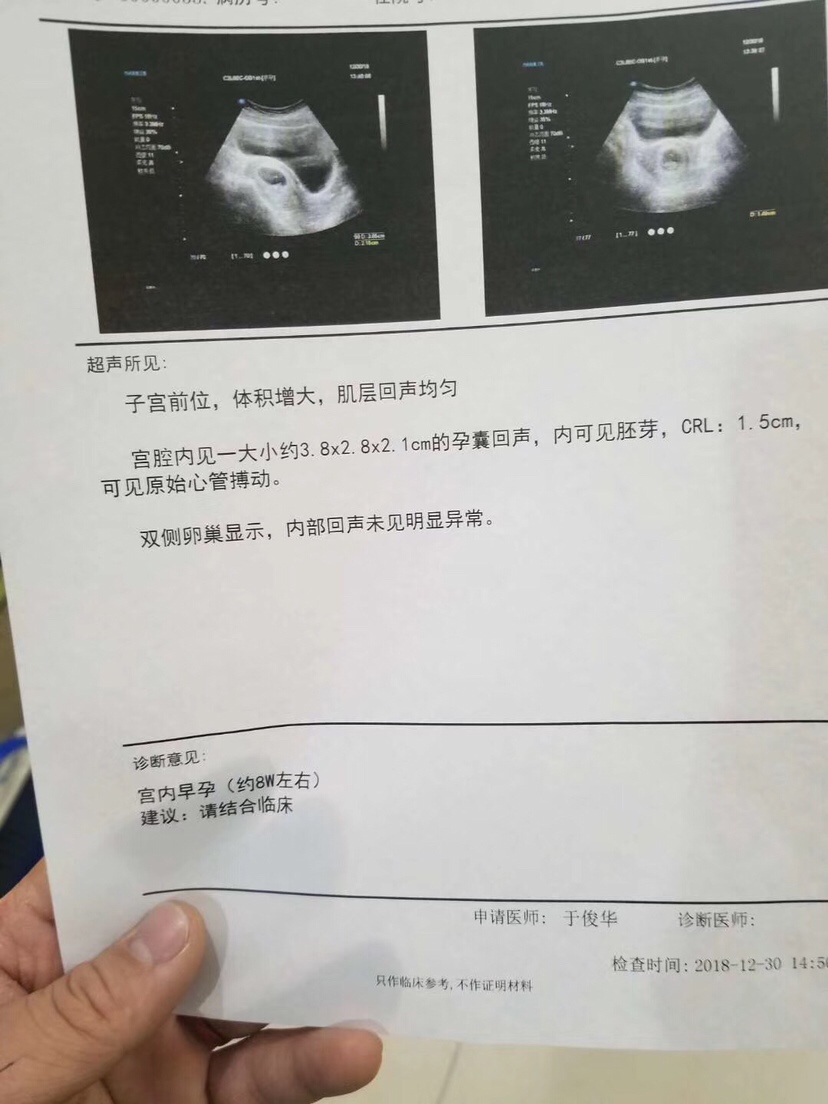 哈哈哈，太高兴了，今天去医院，胎心胎芽都有了