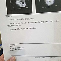 哈哈哈，太高兴了，今天去医院，胎心胎芽都有了