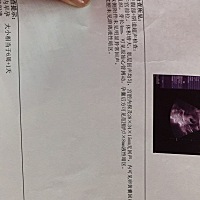 能通过b超看男女吗？因为是二宝，想要个男宝