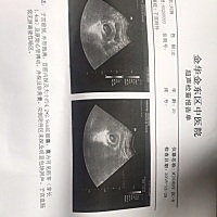 怀孕48天，孩子发育成这样正常吗？