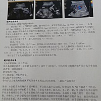 孕23+4做的排畸，医生说胎儿偏小太多，发育不好，我姨妈周期一直是拖后的，一般40-45天的周期，医生让做...