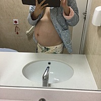 无语了 剖腹产刀口疼的哭了一夜 婆婆嫌我不坚强 就不让我打止痛药 说止痛药喂奶不好 后来我妈在旁边找的...