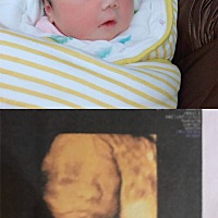 大家看看宝宝的四维照和出生时照片像吗 ？