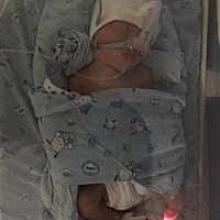 2018.12.26凌晨3点多破腹产喜得龙凤胎 大宝男孩儿，3.6斤，小宝女孩儿，3.6斤 因为33周早产，宝宝都...