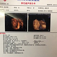 提前一个半月去预约的四维 到了医生说肚皮太厚看不清楚就给换成了普通的彩超 有没有一样情况的宝妈  要...