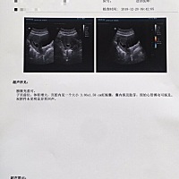 男宝女宝？？？