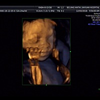 四维照片 宝宝第一张照片留念