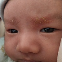 有谁知 道宝宝眉毛上长的是什么吗？