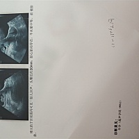 有没有不知道怀孕吃了药的孕妈们啊好担心啊😥