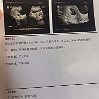 可以看出男孩女孩吗？真的很好奇