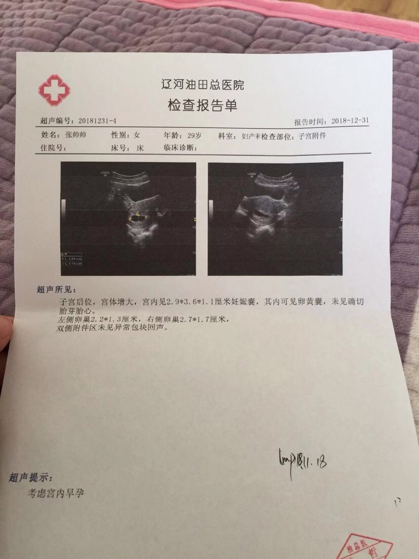 怀孕43天，做B超没看见胎心胎芽，大夫说十有八九保不住了，有宝妈有过这样的情况吗，🙏