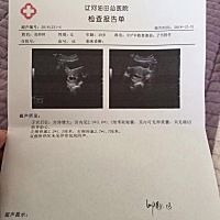 怀孕43天，做B超没看见胎心胎芽，大夫说十有八九保不住了，有宝妈有过这样的情况吗，🙏