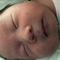 宝宝出生22天，就这两天突然脸上出现很多红点，摸起来脸很粗躁！宝妈们有什么好办法！谢谢🙏