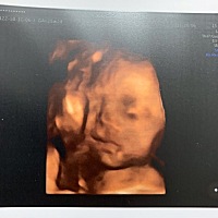 看着像男孩还是女孩