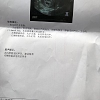 最后一次月经11月25号的 今天去做阴超说没看见卵黄巢 有没有事啊？？？好怕