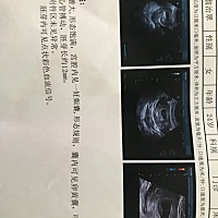 帮忙看看是怎么看的 看不懂胎儿