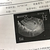 最后一次例假11月22号到今天去做阴超还没见到胚芽，不知道是不是正常好担心
