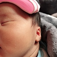 宝宝脸上有小粉刺请问哪位宝妈知道该如何做？有没有什么可以擦的🙏🙏🙏