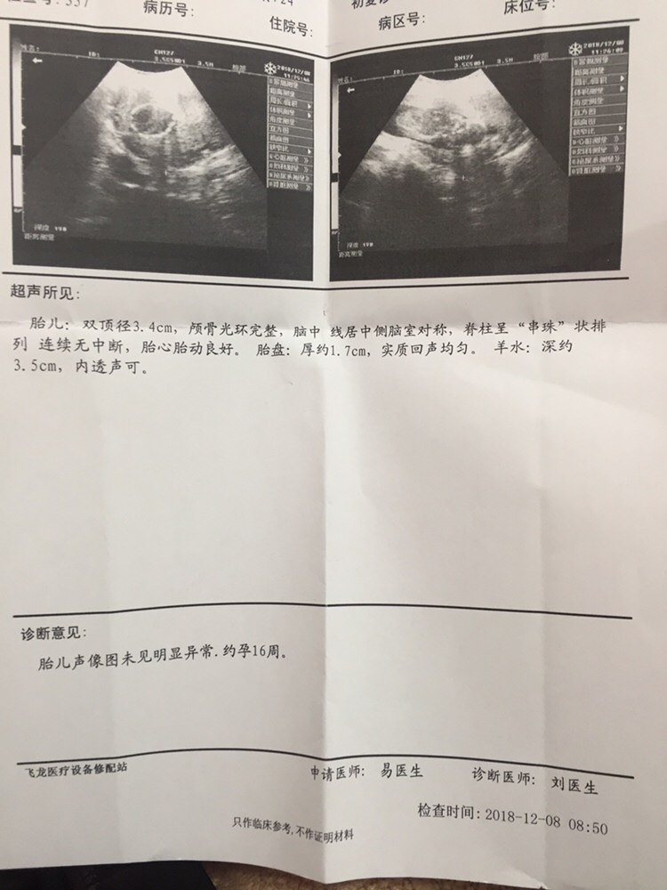 16周的Ｂ超单圈友们帮我看看是男宝还女宝we