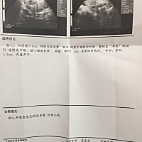 16周的Ｂ超单圈友们帮我看看是男宝还女宝we